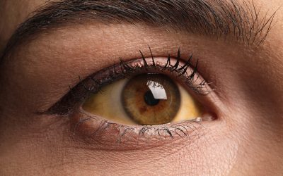 Medical Conditions while Homeless